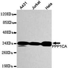 PPP1CA Monoclonal Antibody